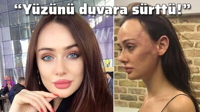 "Dövmedim, tuttum! Yüzünü duvara sürttü!"