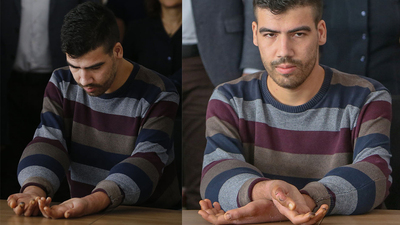 Çift kol nakilli Yusuf o korkusunu yendi!