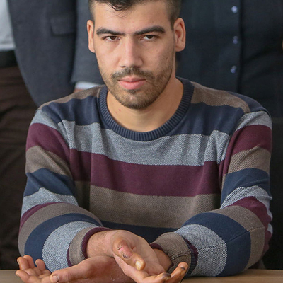 Çift kol nakilli Yusuf o korkusunu yendi!