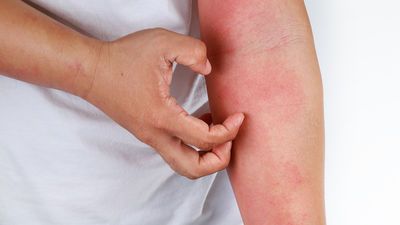 Dikkat! Cinsel yolla bile bulaşıyor