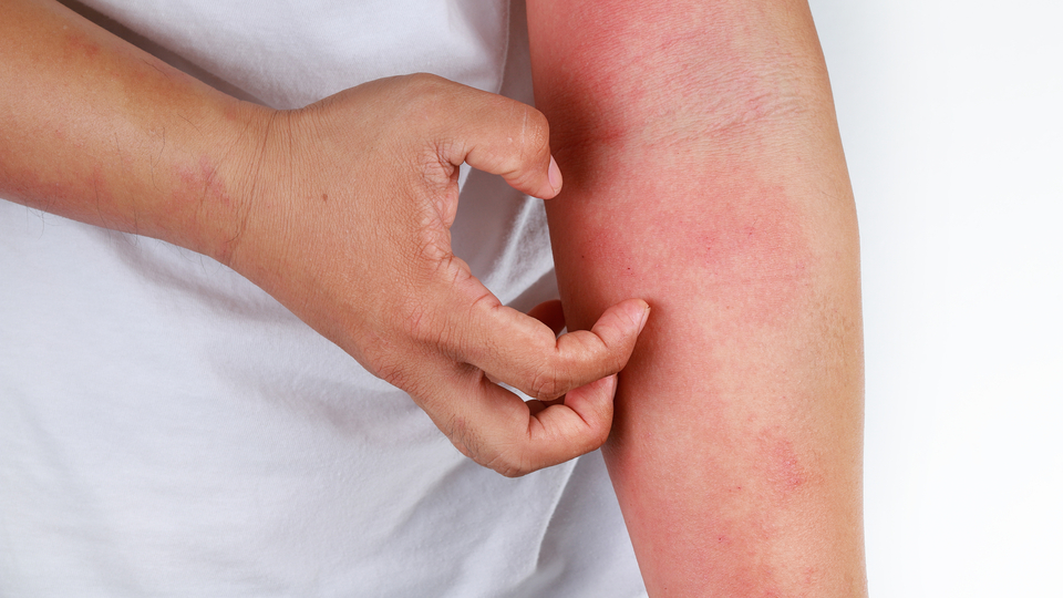 Dikkat! Cinsel yolla bile bulaşıyor