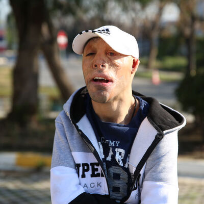 Artık gülmek istiyor!