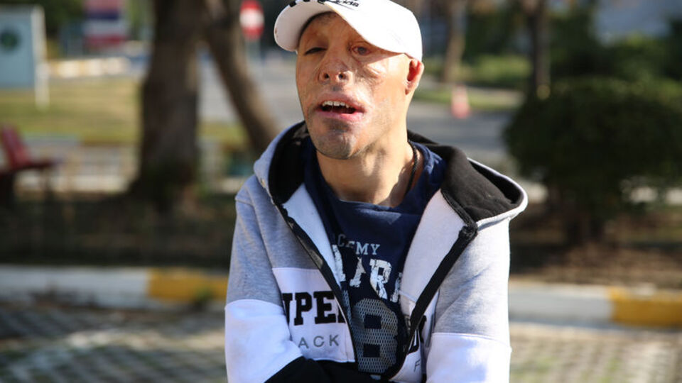 Artık gülmek istiyor!