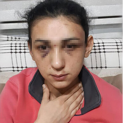 Genç kadının yardım çığlığı