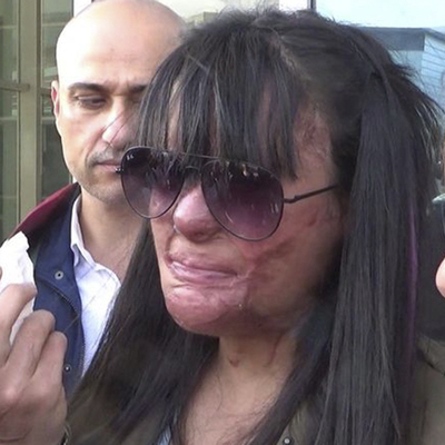 Asit vahşetine şaşırtan ceza!