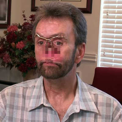 13 yıl böyle yaşadı! Değişimi şoke etti