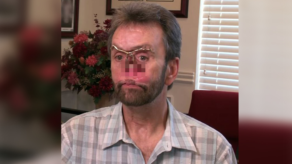 13 yıl böyle yaşadı! Değişimi şoke etti