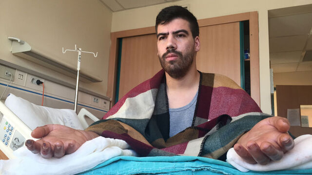 Tırnakları uzamaya başladı!