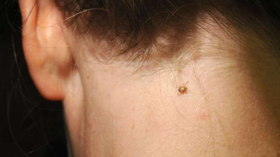 Lyme hastalığı nedir? Belirtileri ve tedavisi nasıldır?