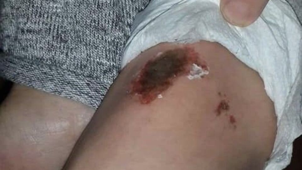 Kar topu oynadılar, sonrası korkunç!