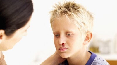 Hemofili nedir, belirtileri nelerdir?