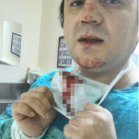 Darbedilen doktor, saldırganın eşine doğum yaptırdı