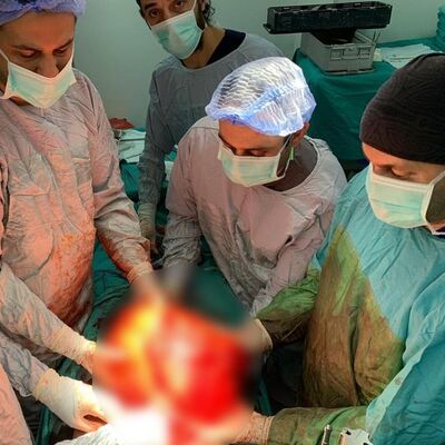 Karın şişkinliği sanıyordu! Bakın ne çıktı...