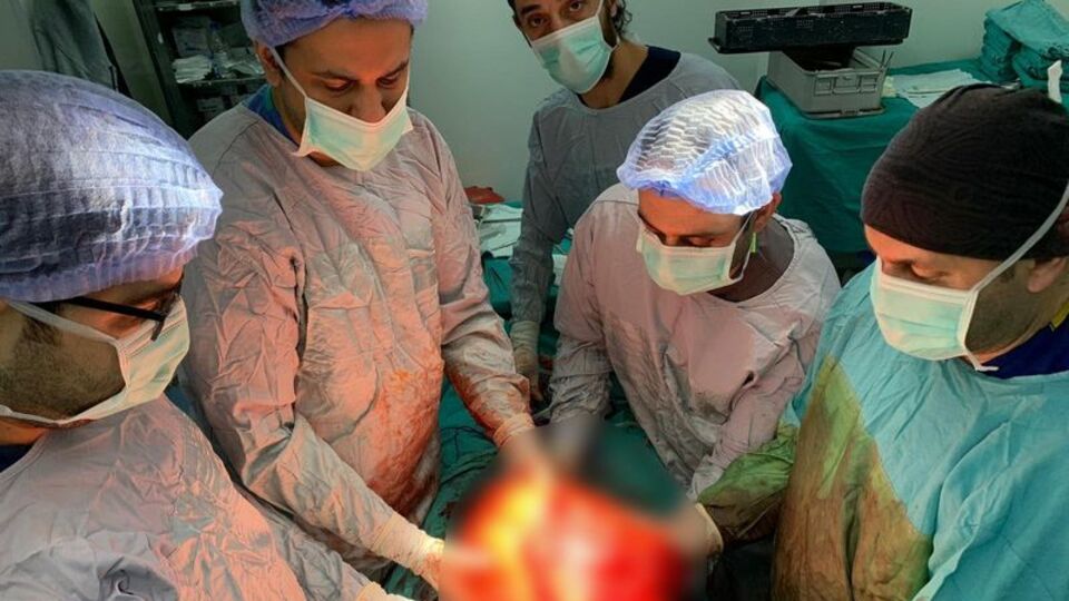 Karın şişkinliği sanıyordu! Bakın ne çıktı...