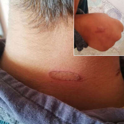 Öğretmenden kızgın soba maşasıyla şiddet!