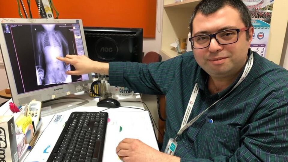 Röntgende ortaya çıktı!