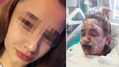 Sınav kaygısı için ilaç aldı! Kör oldu!