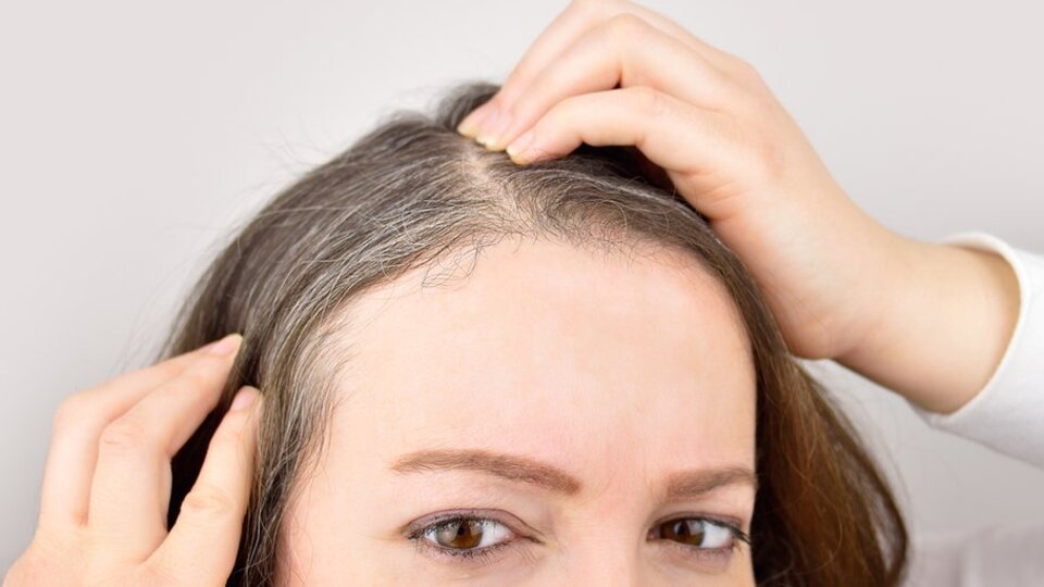 Stres saçları nasıl beyazlatıyor?