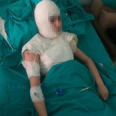 Üvey anne dehşeti! Kaynar suyla haşladı!