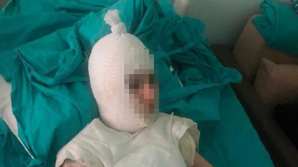 Üvey anne dehşeti! Kaynar suyla haşladı!