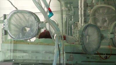 Doğduktan saatler sonra tespit edildi!