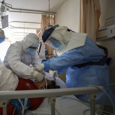 1 günde 98 ölü! Vaka sayısı 72 bin 436 oldu!