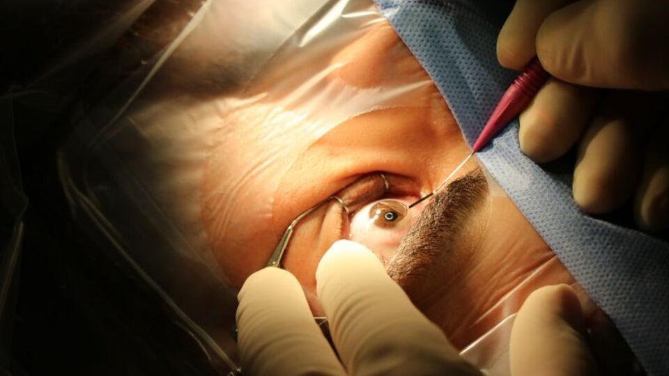 Miyop nedir? Miyop belirtileri nelerdir?