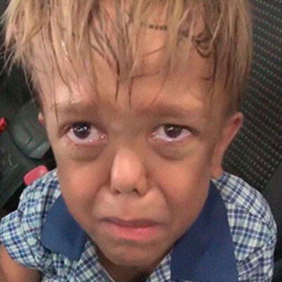 ‘Cüce’ olduğu için dalga geçtiler... Ağlayarak isyan etti