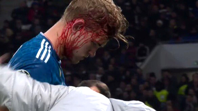 Kanlar içinde kaldı! Korku dolu anlar