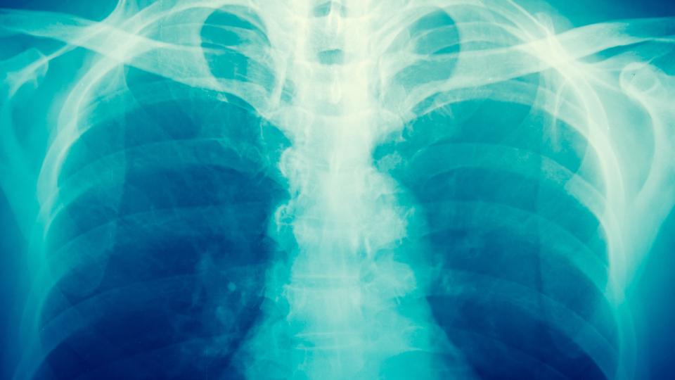 Virüsü böyle yayıyor!