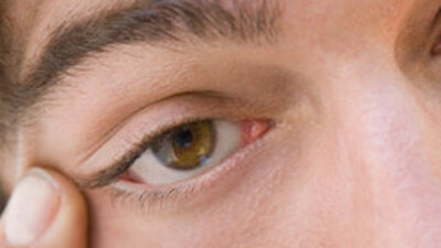 Göz ağrısı neden olur?