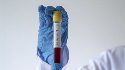 İran'da deprem! Van'da da hissedildi