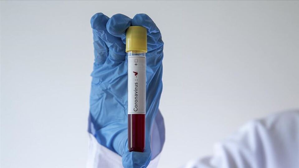 İran'da deprem! Van'da da hissedildi