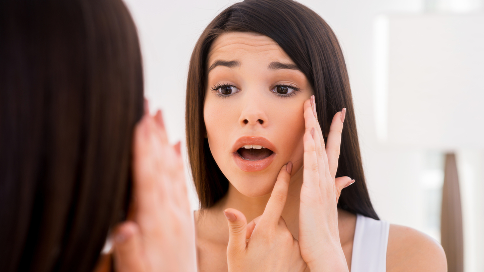 Cilt lekesi nasıl gider?