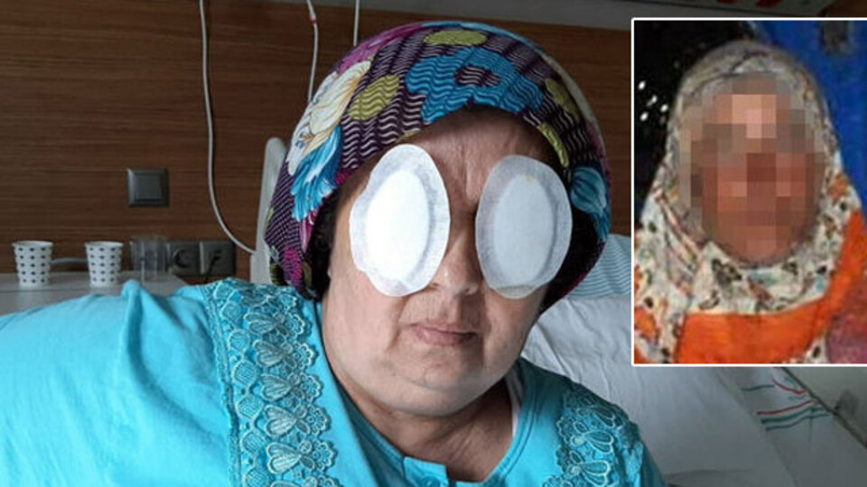 Gözlerini oymuştu! Bu vahşetin son perdesiymiş!