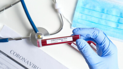 Koronavirüs testi yapan hastaneler hangileri?