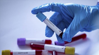 Yerli girişimden koronavirüse özel cihaz