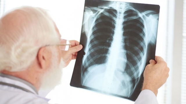 Zatürre (Pnömoni) nedir? Belirtileri ve tedavisi nasıldır?