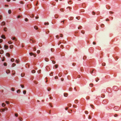 Yeni bir salgın mı?