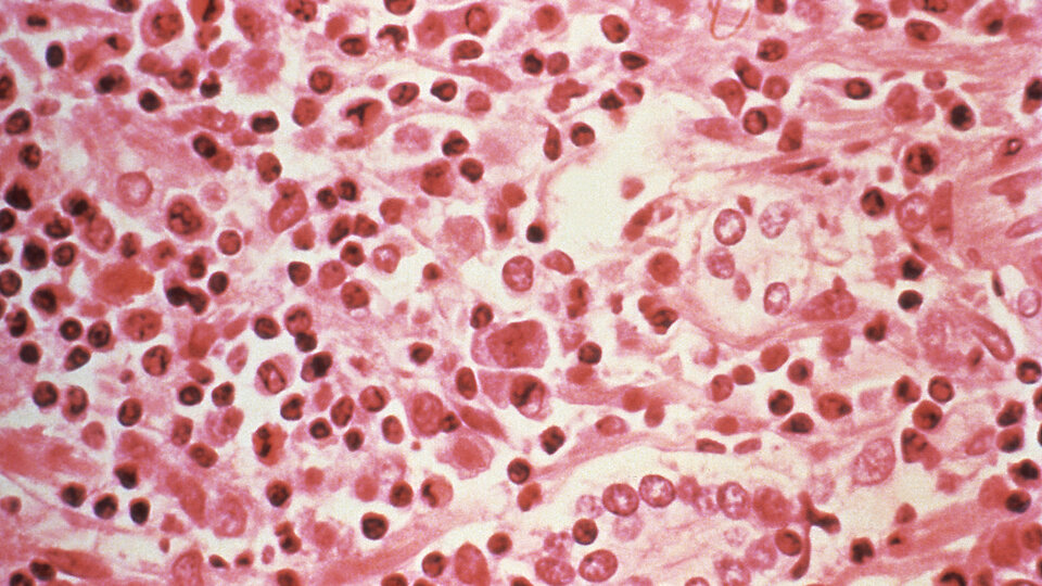 Yeni bir salgın mı?