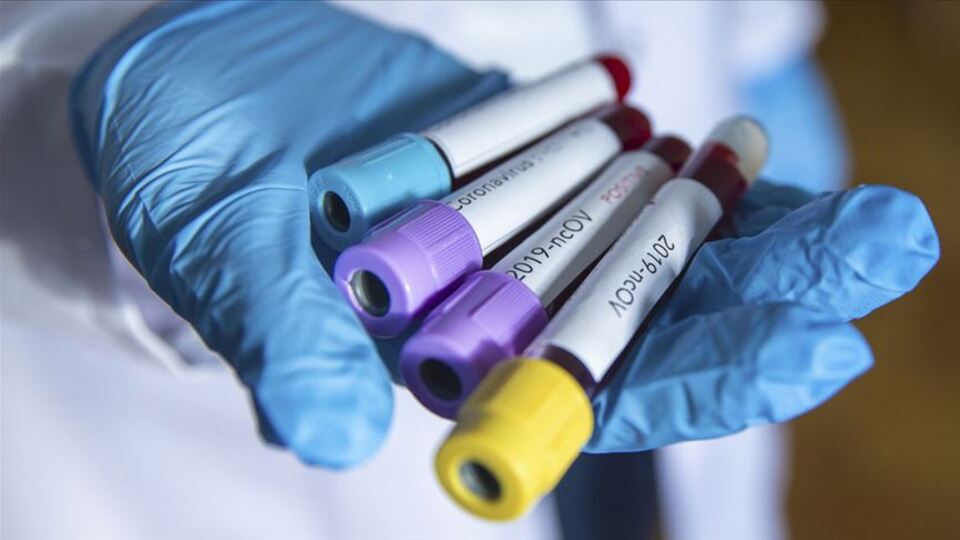 Türkiye'den Kolombiya'ya 26 bin Kovid-19 tanı testi