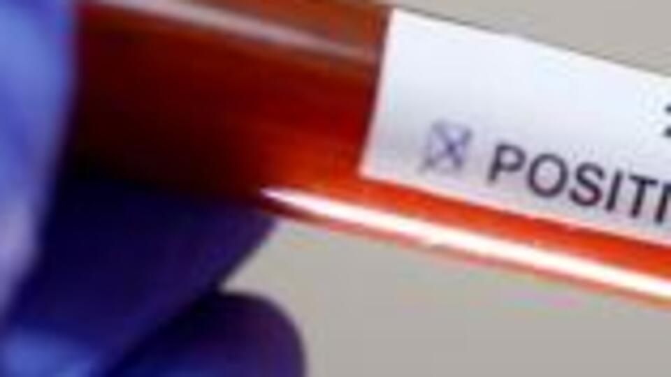 KKTC'de koronavirüs vaka sayısı 42'ye yükseldi