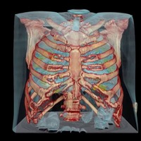 Koronavirüslü akciğerin görüntüsü paylaşıldı