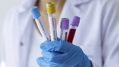 Koronavirüse en çok o ülkeler çare arıyor