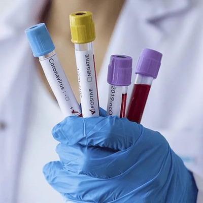 Koronavirüse en çok o ülkeler çare arıyor