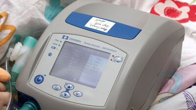 Solunum yetmezliği neden olur?