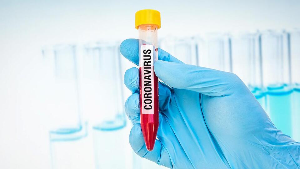 Filyasyon nedir, ne anlama geliyor?