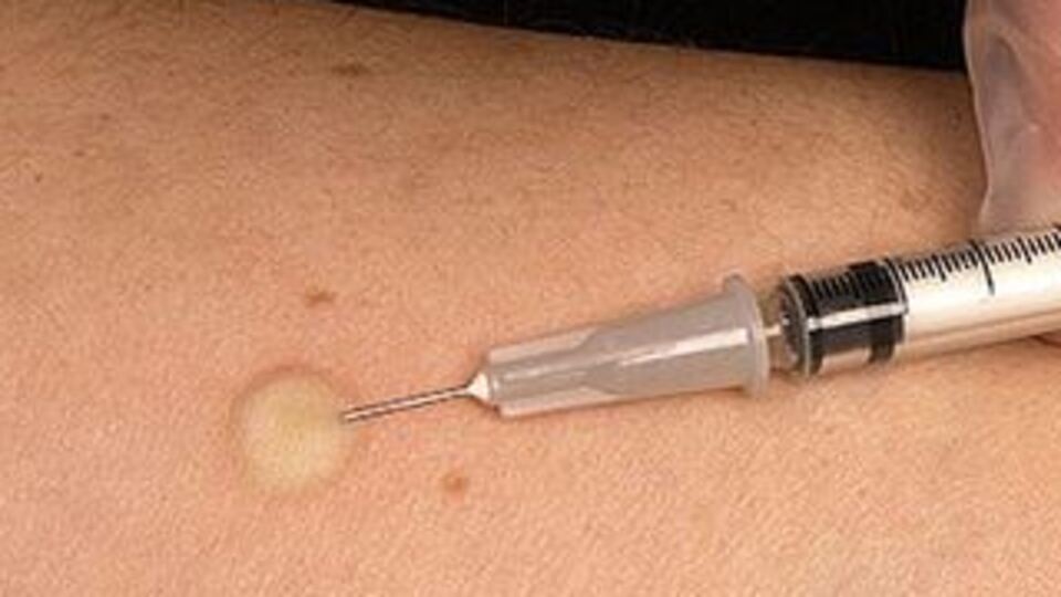 Eylüle kadar insanlar üzerinde denenmeye başlanacak