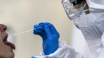 Koronavirüse yakalandığını domates salçası sayesinde anladı