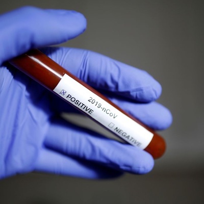 Koronavirüs salgınında can kaybı 356'ya yükseldi